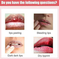 Lips Bleaching Cream Balm